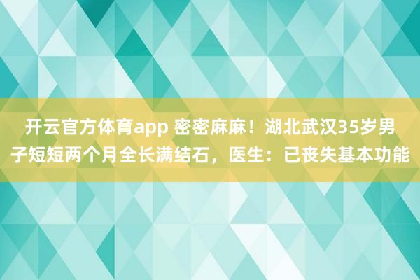 开云官方体育app 密密麻麻!湖北武汉35岁男子短短两个月全长满结石,医生:已丧失基本功能